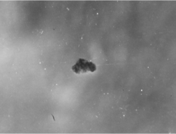 ЭЛЕКТРОННАЯ МИКРОСКОПИЯ  АЛЛОГЕННОГО ГИДРОКСИАПАТИТА